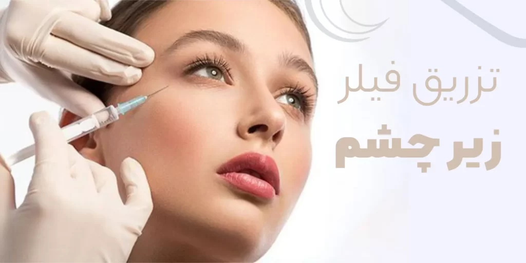 تزریق فیلر زیر چشن