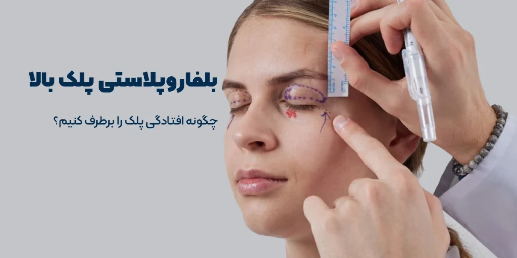 بلفاروپلاستی پلک بالا؛ راهنمای کامل جوانسازی چشم‌ها