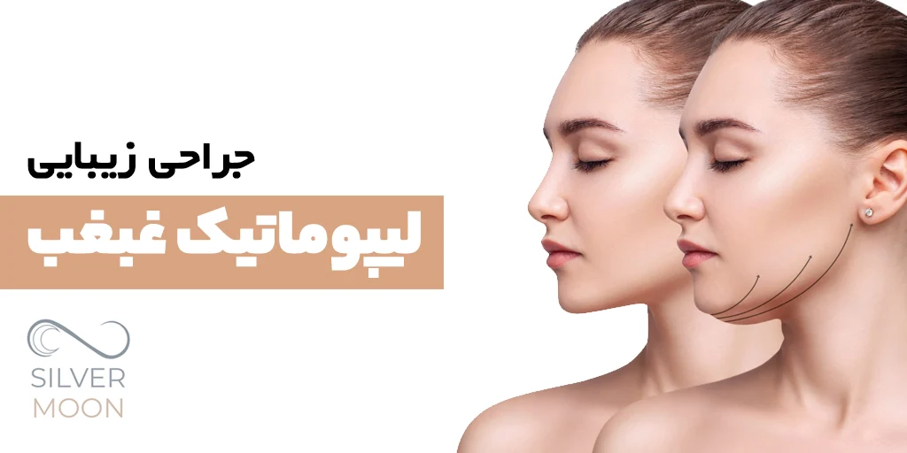 لیپوماتیک غبغب چیست؟ مزیت ها و مراحل