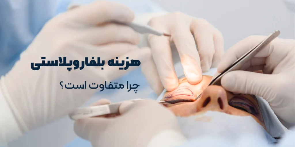 هزینه عمل بلفاروپلاستی