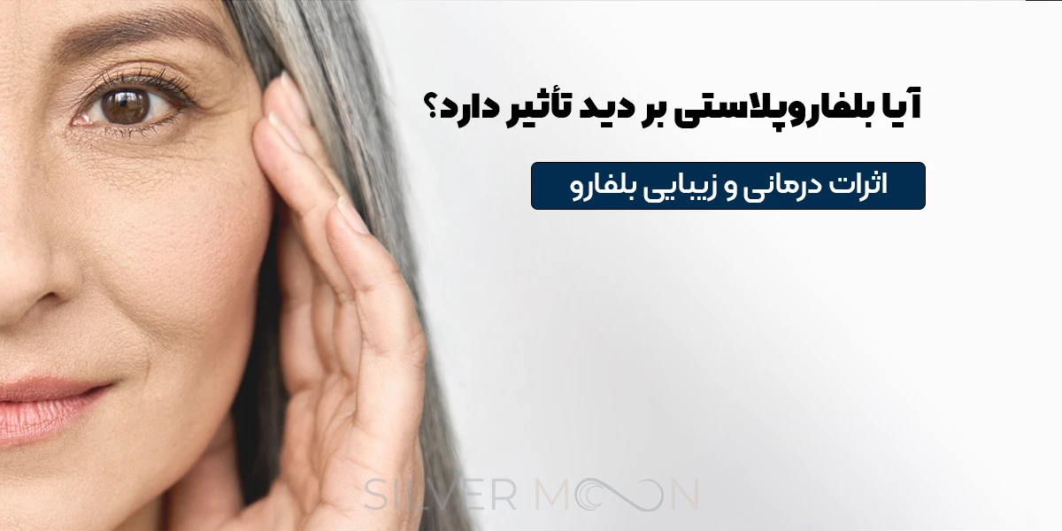 آیا بلفاروپلاستی بر دید تأثیر دارد؟