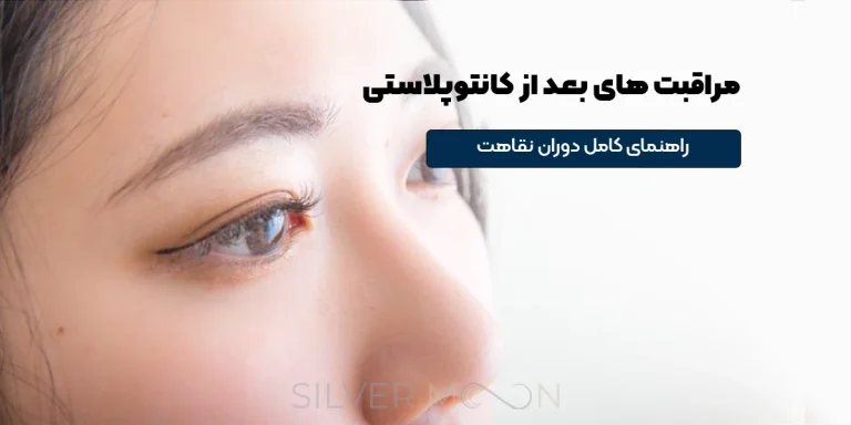 مراقبت‌های بعد از کانتوپلاستی