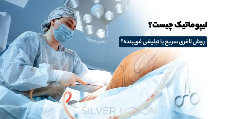 لیپوماتیک چیست؟