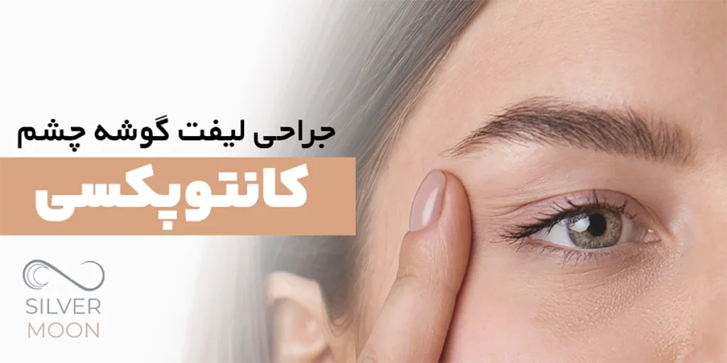 صفر تا صد عمل کانتوپکسی | هر آنچه باید قبل از جراحی بدانید