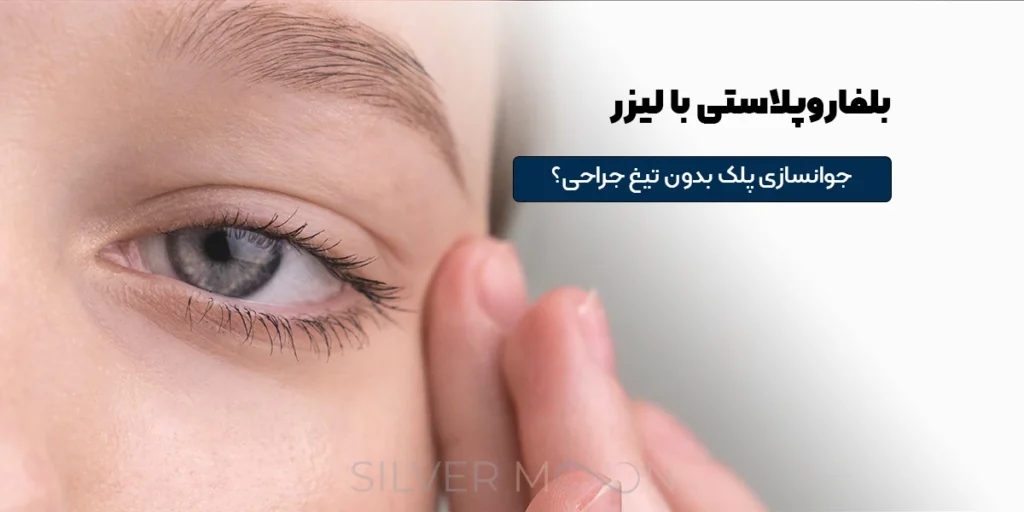 بلفاروپلاستی با لیزر