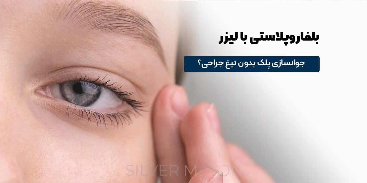 بلفاروپلاستی با لیزر