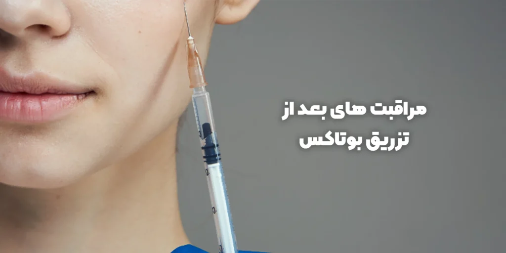 مراقبت های بعد از بوتاکس