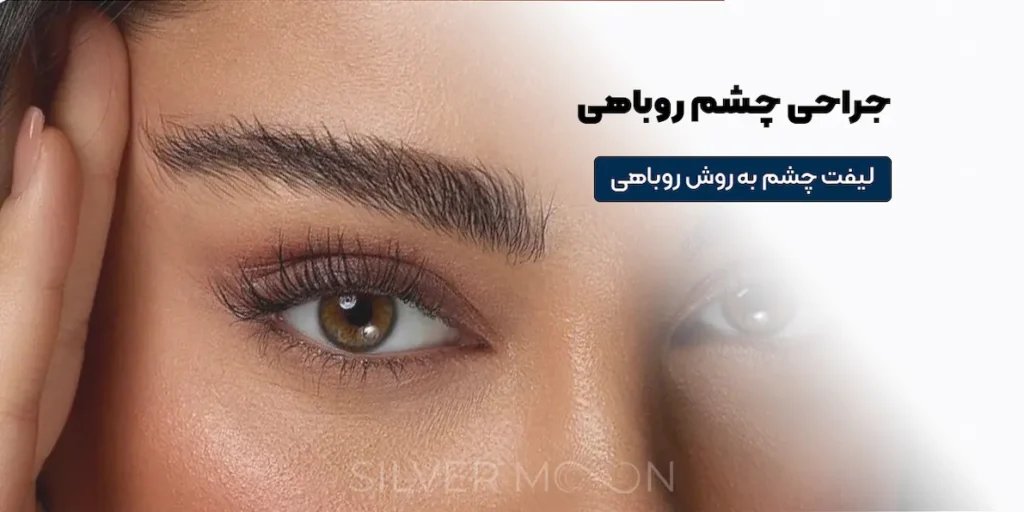 جراحی چشم روباهی