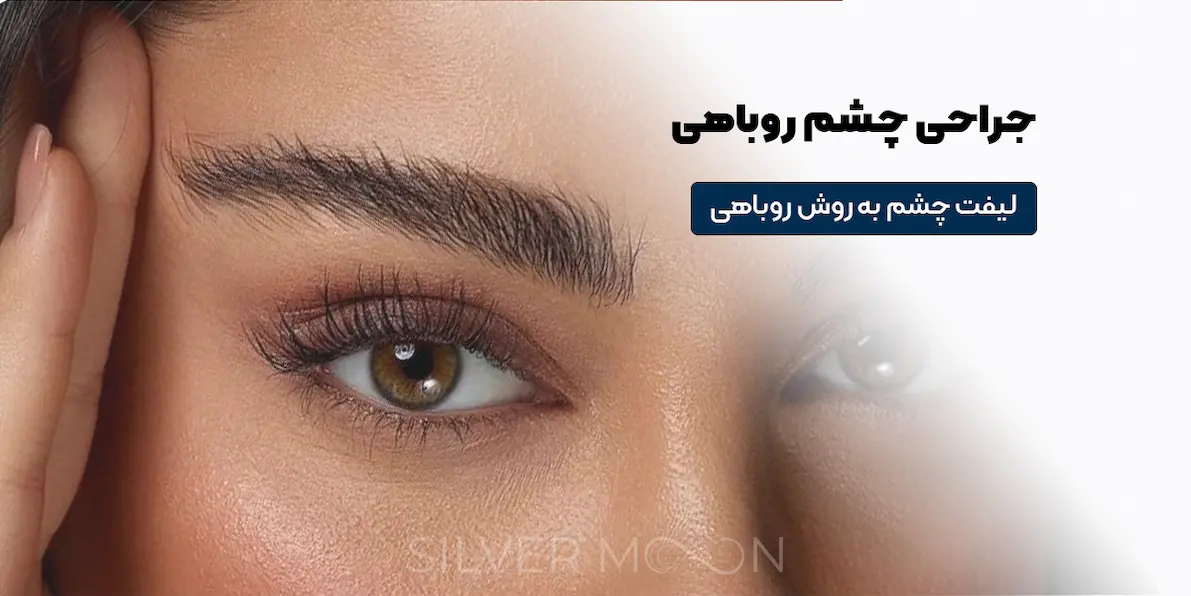 جراحی چشم روباهی