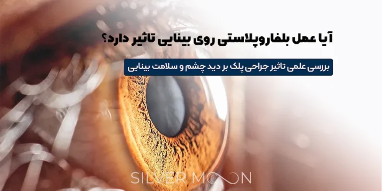 عمل بلفاروپلاستی روی بینایی