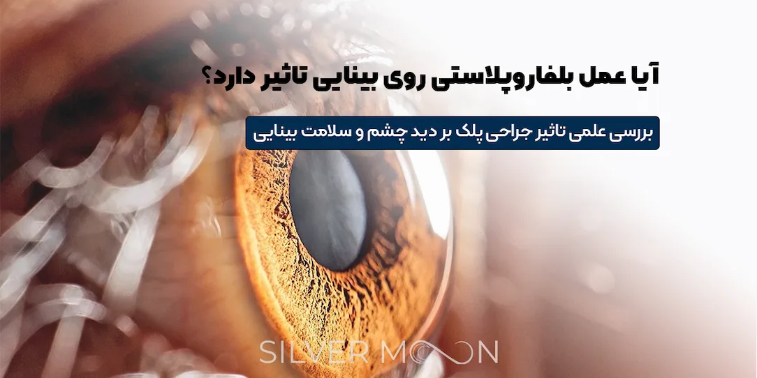 عمل بلفاروپلاستی روی بینایی