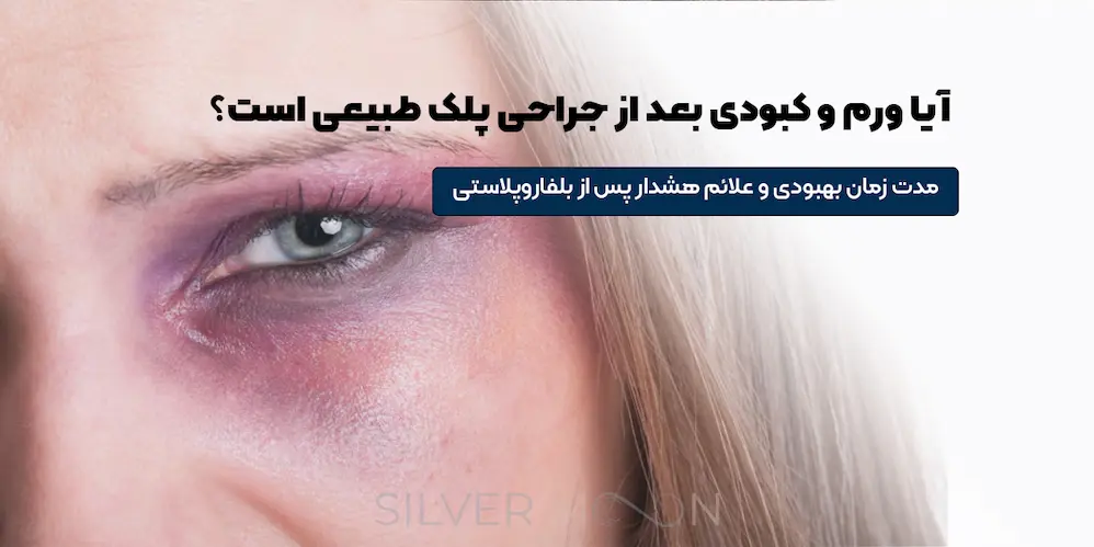 صفحه اصلی 56 آیا ورم و کبودی بعد از جراحی پلک طبیعی است؟
