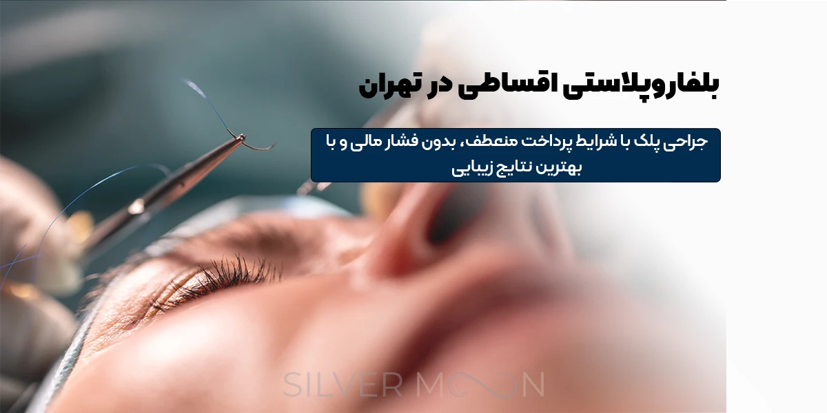 بلفاروپلاستی اقساطی در تهران | شرایط ویژه