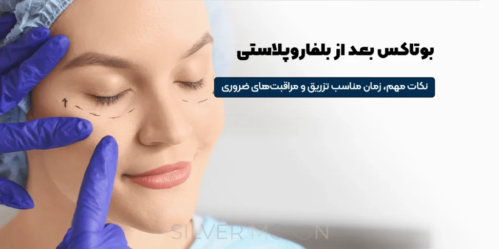 صفحه اصلی 63 بوتاکس بعد از بلفاروپلاستی