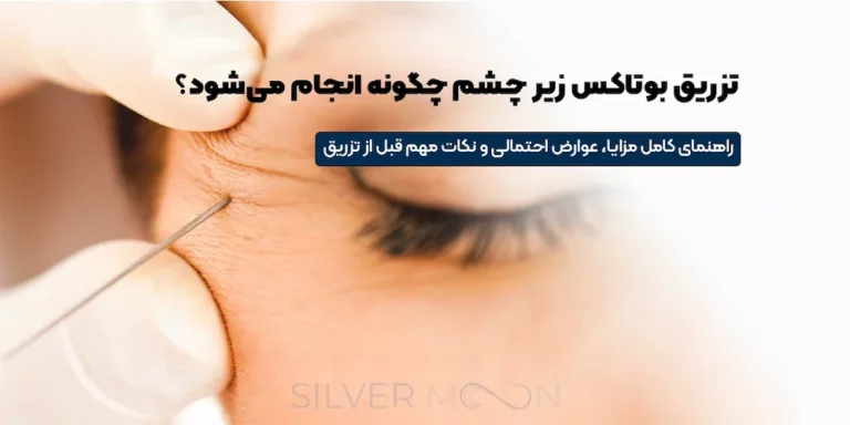 تزریق بوتاکس زیر چشم چگونه انجام می_شود؟