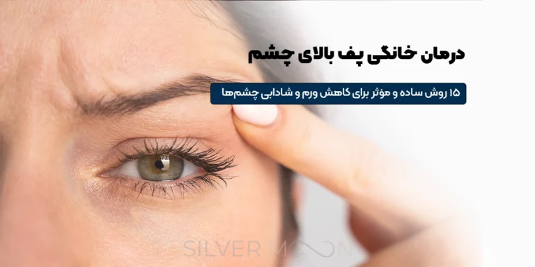 درمان خانگی پف بالای چشم