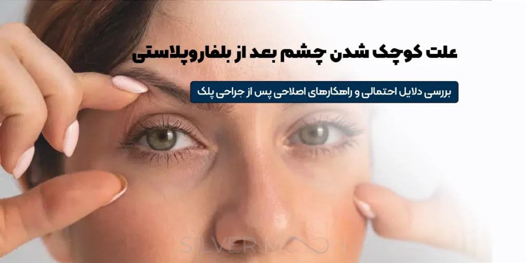صفحه اصلی 70 علت کوچک شدن چشم بعد از عمل بلفاروپلاستی