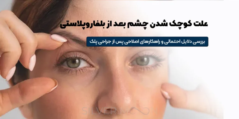 علت کوچک شدن چشم بعد از عمل بلفاروپلاستی