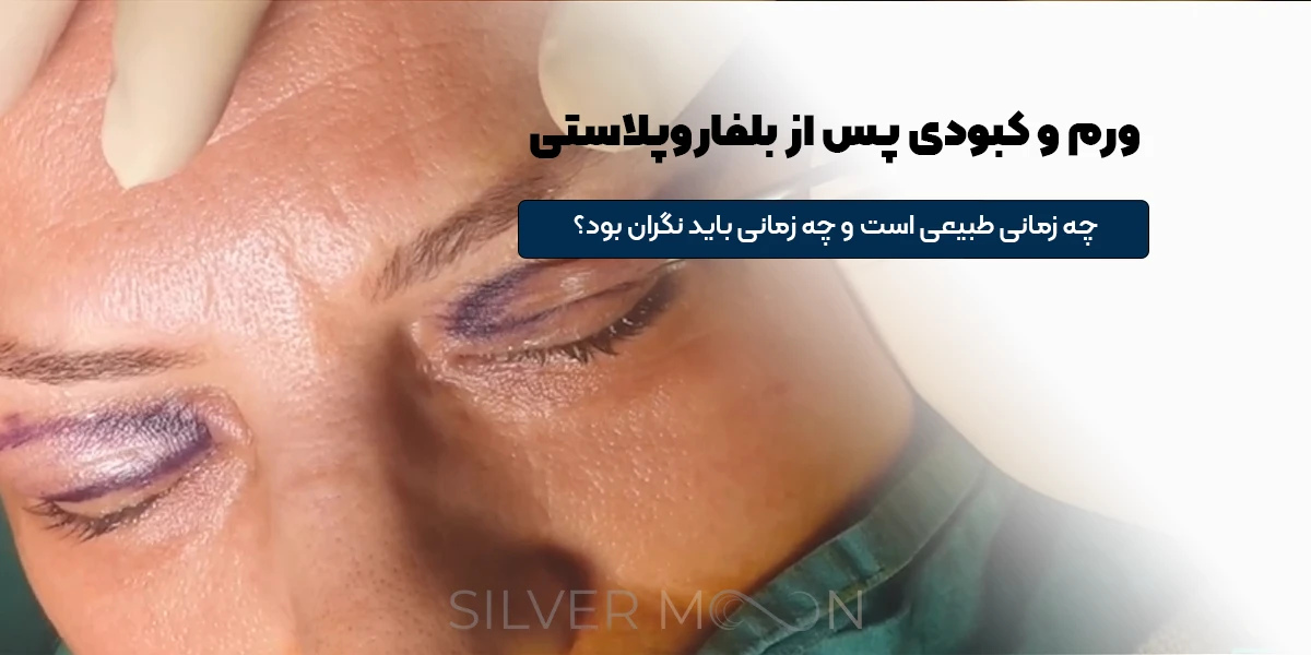 ورم و کبودی پس از بلفاروپلاستی