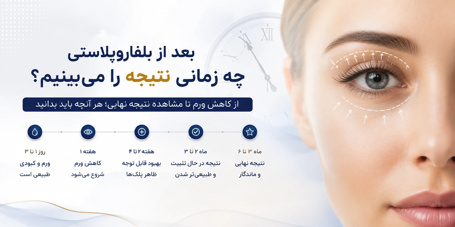نتایج بلفاروپلاستی