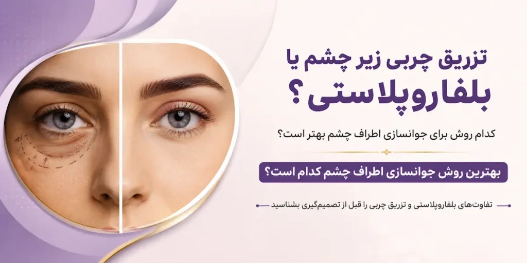 صفحه اصلی 72 تزریق چربی زیر چشم یا بلفاروپلاستی