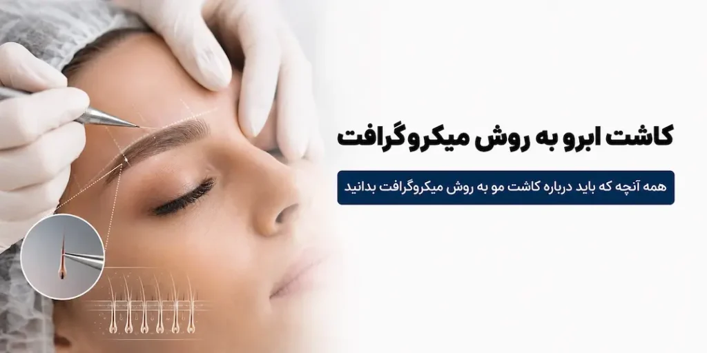 صفحه اصلی 78 کاشت مو به روش میکروگرافت